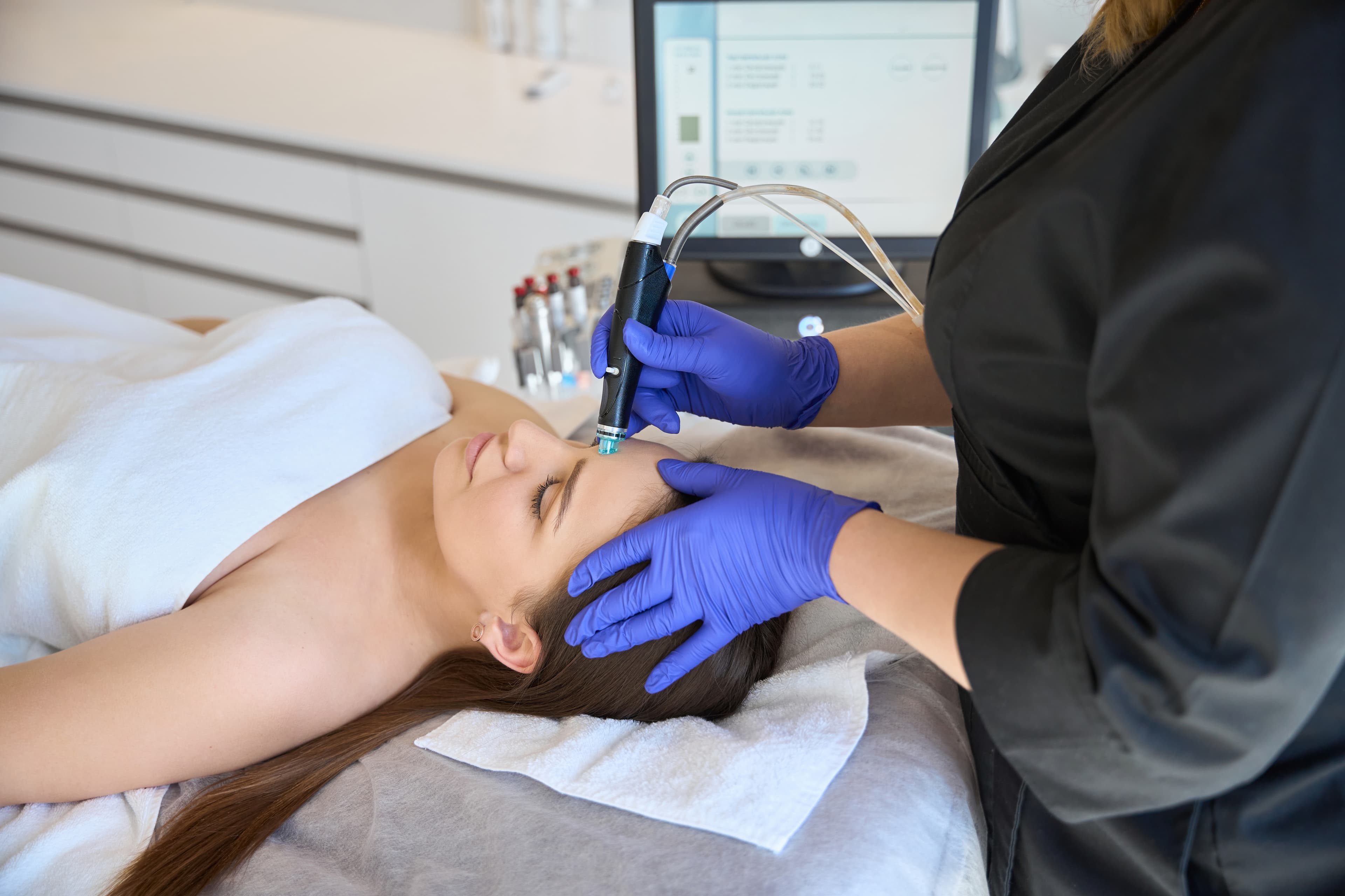 Dermabrasion